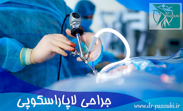 جراحی لاپاراسکوپی جراحی لاپاراسکوپی
