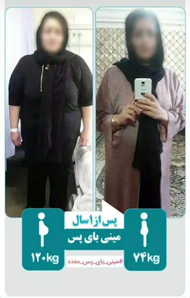 جراحی چاقی دکتر پازوکی