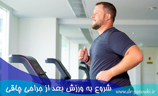 شروع به ورزش بعد از جراحی چاقی