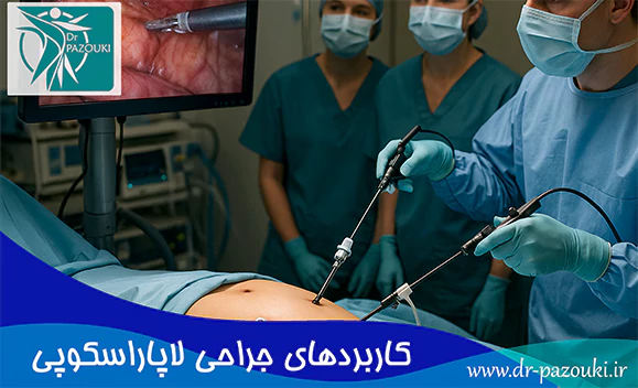 کاربردهای جراحی لاپاراسکوپی کاربردهای جراحی لاپاراسکوپی
