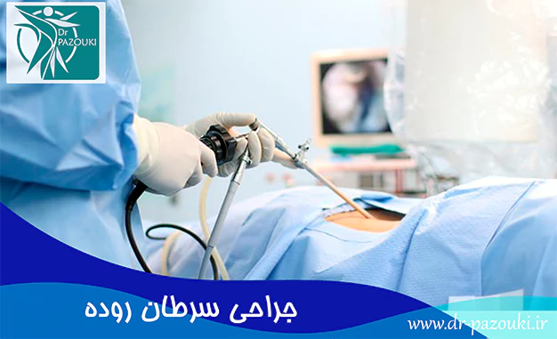 جراحی سرطان روده