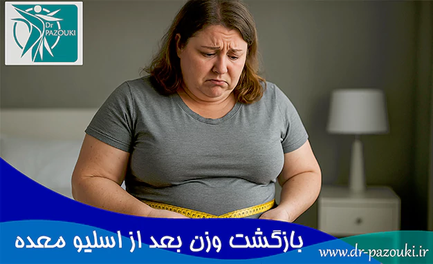 بازگشت وزن بعد از اسلیو معده