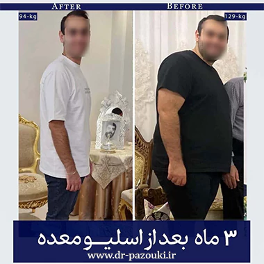 بهترین جراح چاقی دکتر عبدالرضا پازوکی