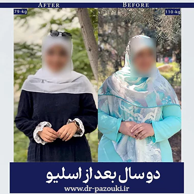 نمونه کار بهترین جراح چاقی