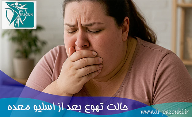 حالت تهوع بعد از اسلیو معده