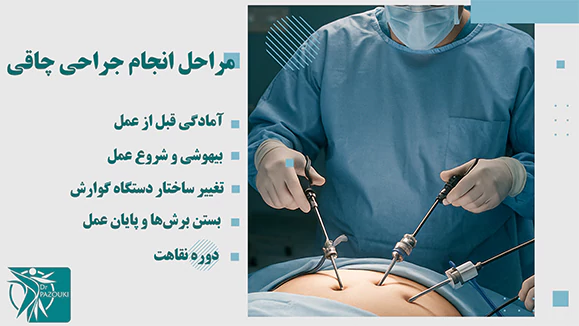 مراحل انجام جراحی چاقی