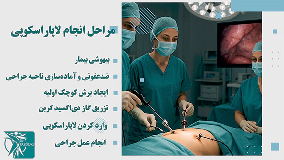 مراحل انجام لاپاراسکوپی مراحل انجام لاپاراسکوپی