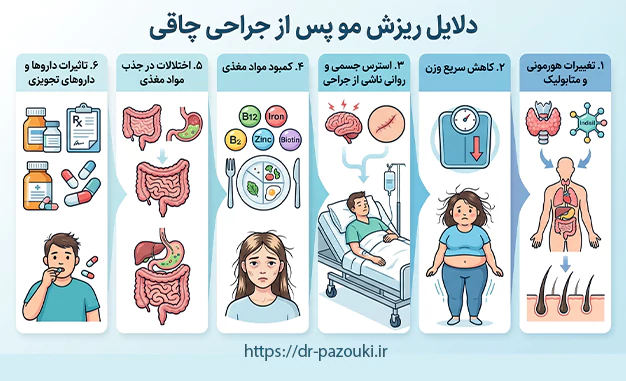 دلایل ریزش مو بعد از جراحی دلایل ریزش مو بعد از جراحی