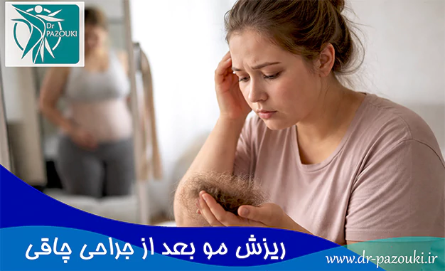 ریزش مو بعد از جراحی چاقی ریزش مو بعد از جراحی چاقی