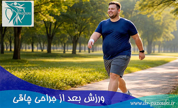 ورزش بعد از جراحی چاقی