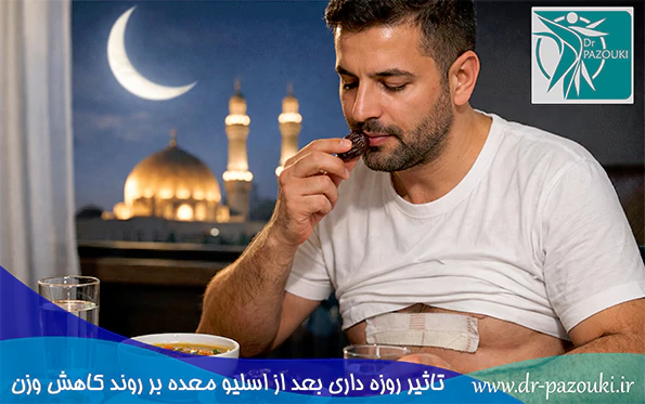 تاثیر روزه داری بعد از اسلیو معده بر روند کاهش وزن